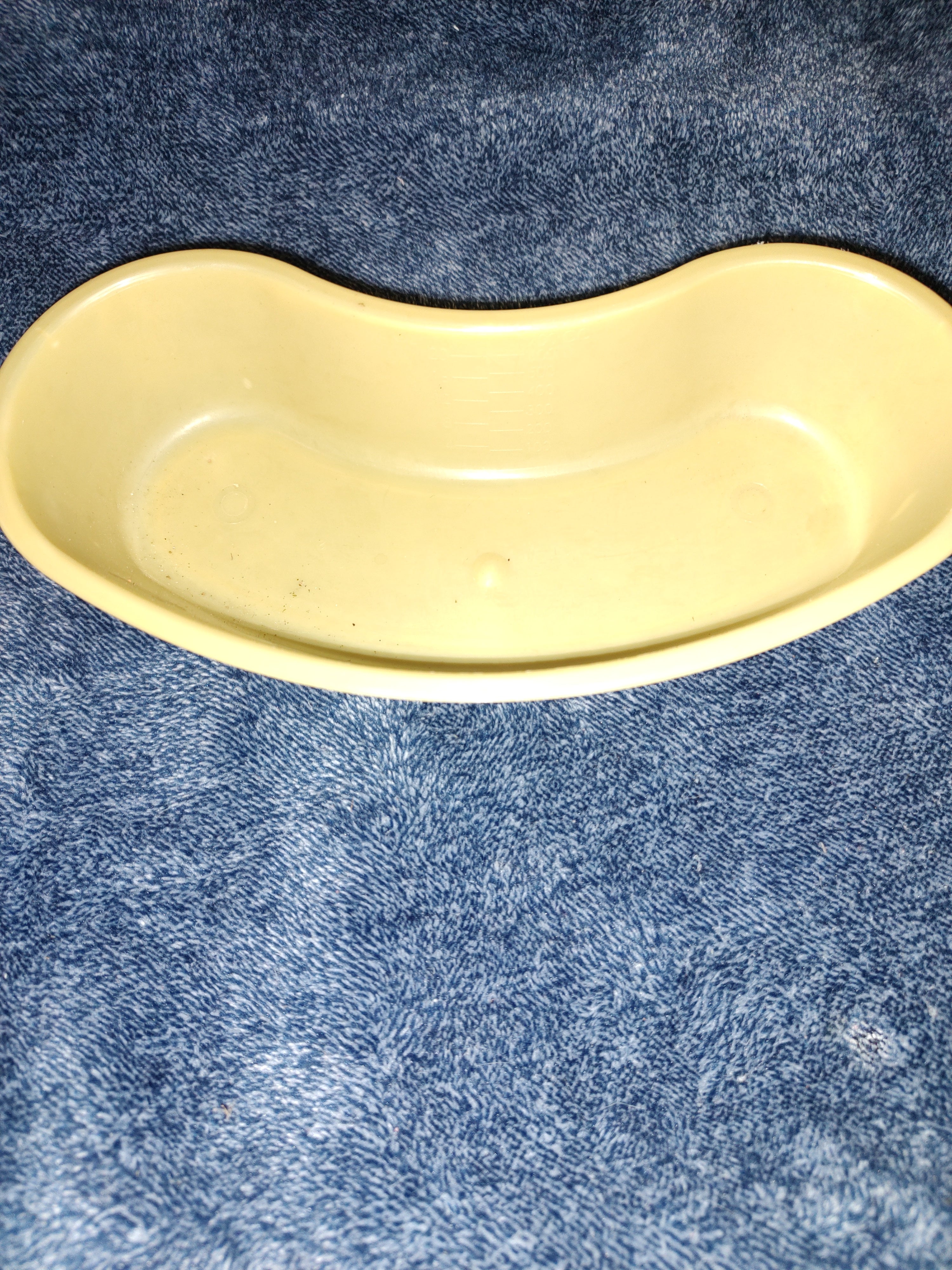 Vomit dish